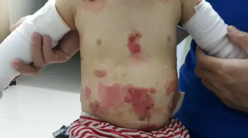 Donation For Pain Medicine - Image 6
